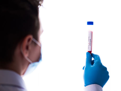 Реальна кількість заражених коронавірусом в Італії може бути в рази більшою – дослідження