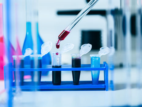 У ЗСУ протягом минулої доби зафіксували 31 новий випадок коронавірусу