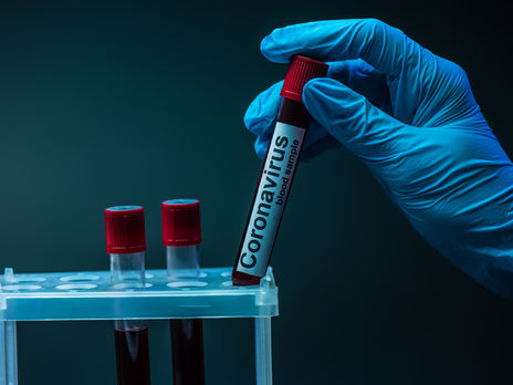 В ВСУ за минувшие сутки зафиксировано 29 новых случаев COVID-19