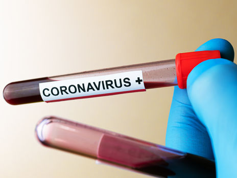 Дев'ять областей України не відповідають умовам послаблення карантину – МОЗ