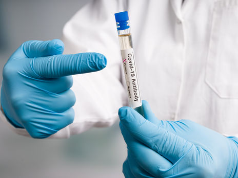 В Киеве за сутки коронавирус подтвердили у 182 человек – Кличко