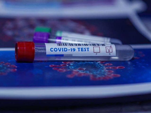 В Украине установлен новый антирекорд по числу выявленных случаев COVID-19. Предыдущий превышен почти на 200