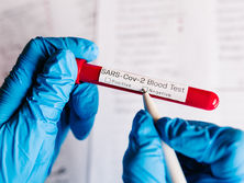 Третий день подряд число новых случаев COVID-19 в Украине фикисируется на уровне 2,1 тыс.