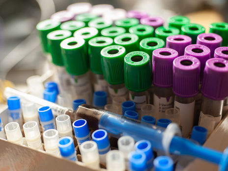 В Украине – рекорд по количеству умерших от коронавируса за сутки