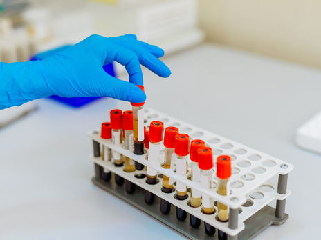 В Украине зафиксирован рекордный суточный прирост инфицированных коронавирусом