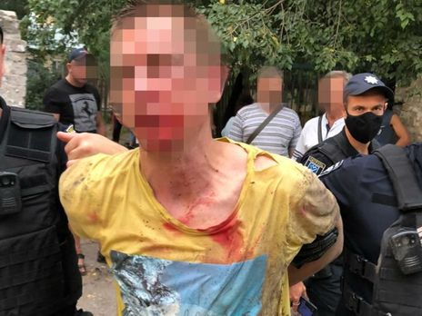 У Дніпрі внаслідок вибуху гранати поранення дістало двоє людей – поліція