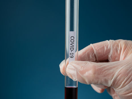 ВОЗ необходимо $35 млрд для борьбы с COVID-19 – Гебрейесус 