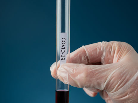 Пациенты с подозрением на COVID-19 не должны сами идти в лабораторию – Степанов