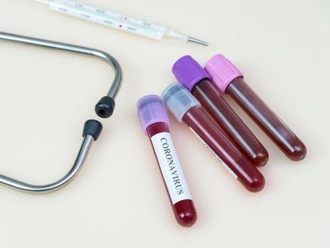 У Києві зробили 168 тис. тестів на коронавірус – Кличко