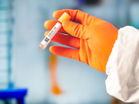 Главный санврач Украины Ляшко допустил рост количества больных COVID-19 до 17 тыс. в день 