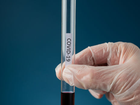 До грудня МОЗ хоче проводити 50 тис. тестувань на коронавірус на добу – Степанов