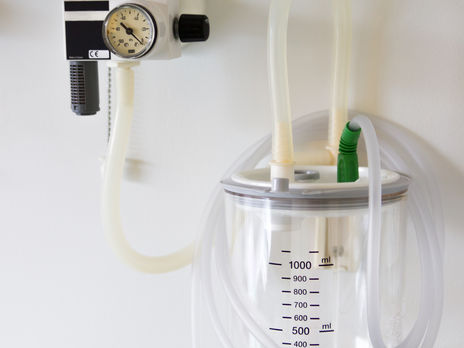 Кабмин выделил почти 600 млн грн на закупку и установку кислородных систем для лечения пациентов с COVID-19