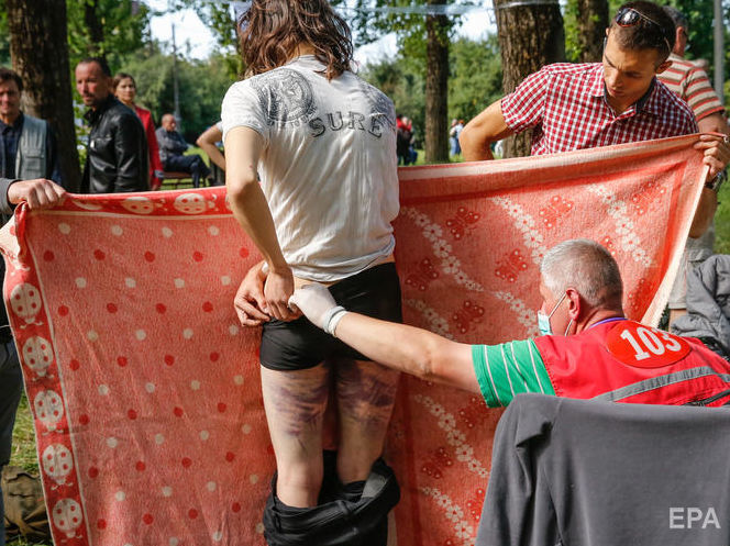 "Травми важчі, ніж ми очікували". Чехія прийняла на лікування понад 40 білорусів, які постраждали під час протестів