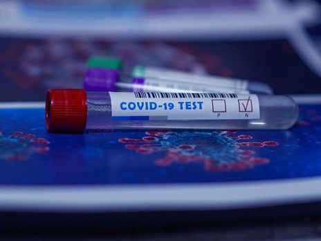 В Україні протягом доби провели майже 63 тис. тестувань на коронавірус