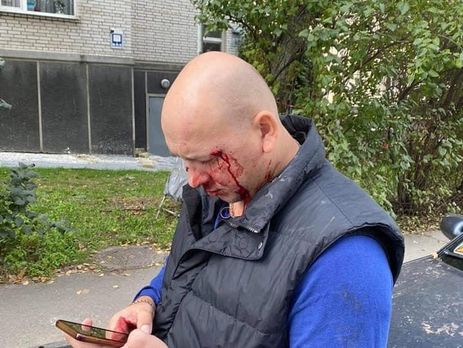 Одного із чоловіків, який побив сержанта Сил спецоперацій ЗСУ Дєєва, повідомили про підозру