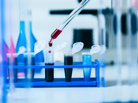 Японские ученые назвали новое последствие коронавируса