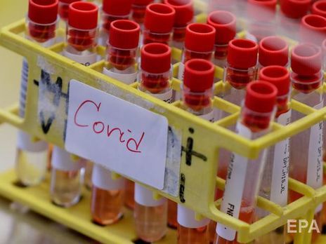 Число новых случаев COVID-19 в Украине за сутки впервые превысило 8 тыс.