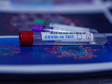В двух регионах Украины за сутки выявили более чем по 700 случаев COVID-19 – Минздрав
