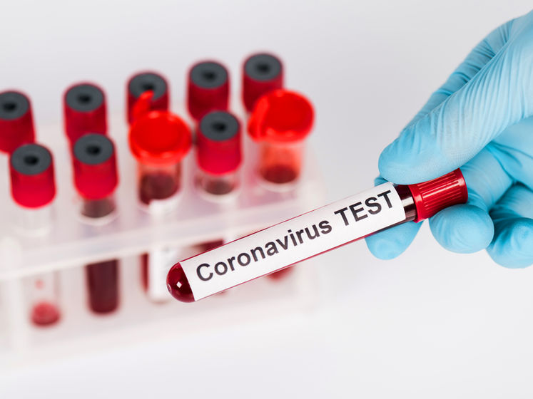 Масове тестування може допомогти "вбити" COVID-19 протягом півтора місяця – дослідження