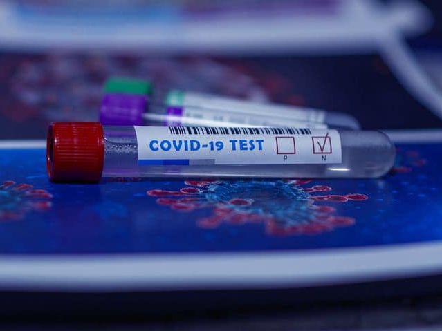 Дніпропетровську область менше за інші регіони охоплено тестуваннями на коронавірус – дані МОЗ за тиждень