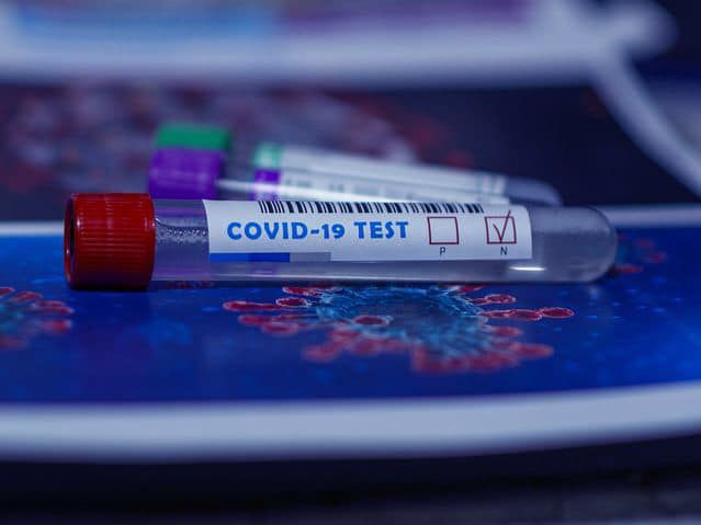 В Україні вперше із серпня зафіксовано зниження тижневого приросту хворих на COVID-19 – МОЗ