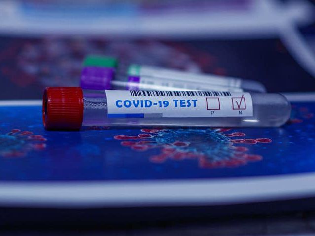 В Україні кількість тестувань на коронавірус зменшилася на 20% – дані МОЗ