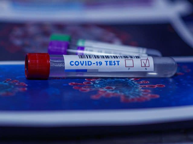 Степанов заявив, що в Україні мають намір "суттєво" збільшити кількість тестувань на коронавірус