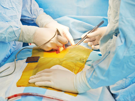 Названа причина смерти 30-летнего мужчины, которому во Львове пересадили сердце