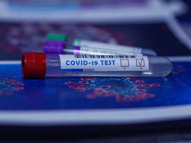 Найнижчий в Україні рівень тестування на коронавірус зафіксовано в Київській області