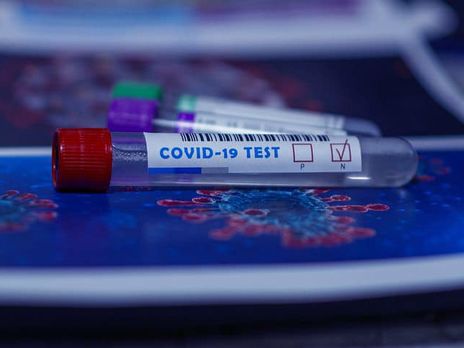Самый низкий в Украине уровень тестирования на коронавирус зафиксирован в Киевской области