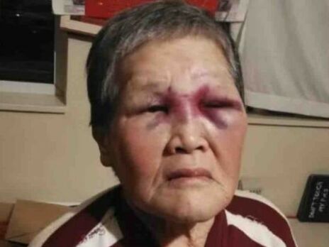 В США мужчина напал на 76-летнюю азиатку. Она смогла отбиться и отправила нападавшего в больницу