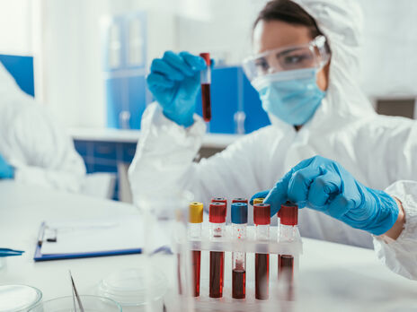 В Україні майже 40% чоловіків вважає, що хворіли на COVID-19. Серед жінок цей показник на рівні 30% – опитування