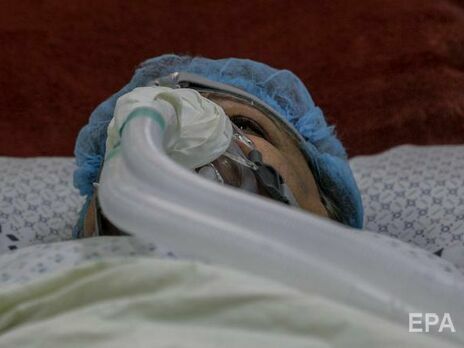 В Україні для пацієнтів із COVID-19 дозволили використовувати технічний кисень. Але є умова