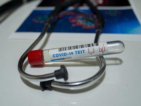 В Україні різко зросла кількість померлих протягом доби пацієнтів із COVID-19