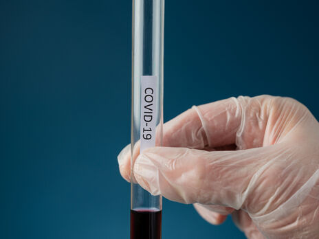 У Львівській області судитимуть чоловіка, який надав прикордонникам підроблений результат тесту на COVID-19