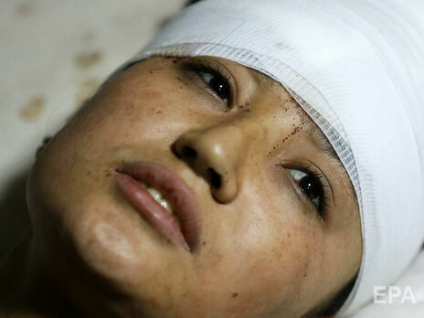 Возле школы для девочек в Кабуле прогремел взрыв, погибло более 30 человек, большинство – дети