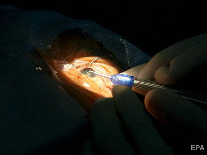 Лікарі змогли частково повернути зір сліпому чоловікові за допомогою генної терапії