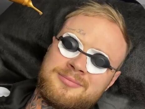 Харьковчанин избавился от татуировки 