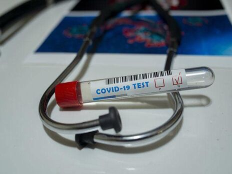 Протягом доби в Україні померло 70 пацієнтів із COVID-19