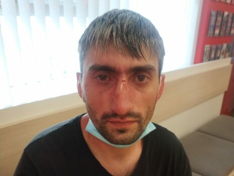 Антимайданівця Топаза побили в Києві