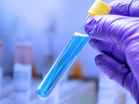 В Ивано-Франковской области увеличилось число пострадавших детей от отравления в лагере. Специалисты начали проверку