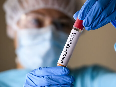 Кузин: Ситуация с COVID-19 ухудшается в каждой области Украины. Вспышку можно ожидать где угодно