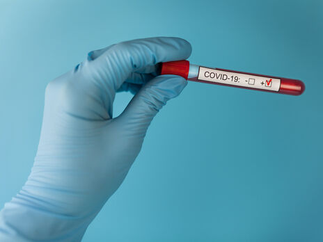 В Сумской области зафиксировали штамм коронавируса 