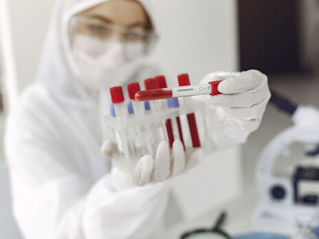 В Україні підтвердили понад 2 тис. випадків COVID-19. Це новий максимум від початку літа