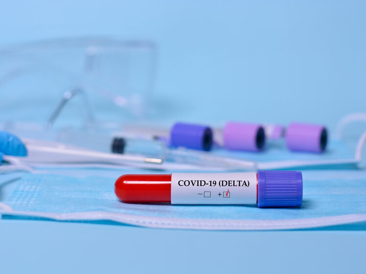 Компанія-резидент технопарку Ярославського повідомила про початок виробництва тестів для виявлення "Дельта"-штаму коронавірусу SARS-CoV-2