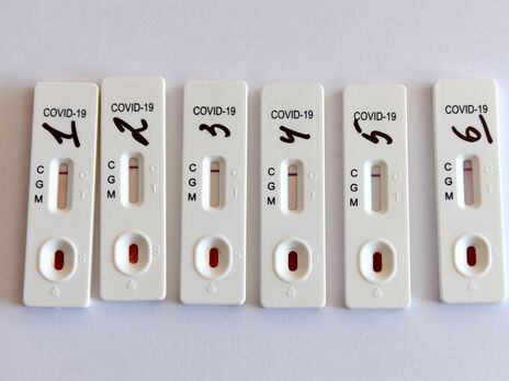 Кабмін України виділив 150 млн грн на діагностику COVID-19