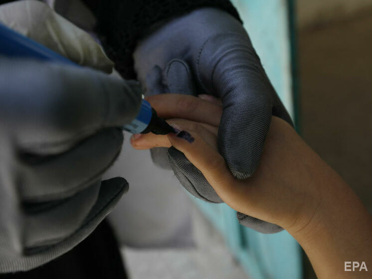 "Може призвести до смерті". Кузін закликав українців вакцинувати дітей проти поліомієліту