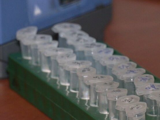 У Польщі почалися випробування української вакцини проти коронавірусу. Її хочуть випускати у вигляді таблеток, мікстури чи спрея
