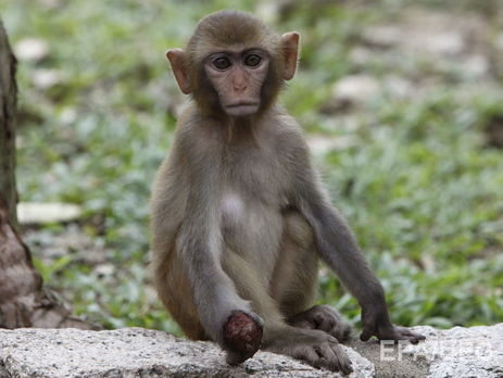 Ученым удалось излечить паралич