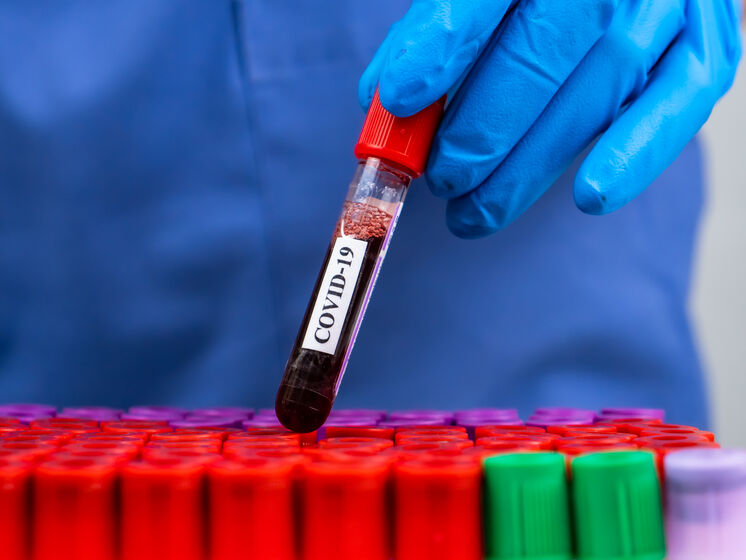 Для визначення штаму коронавірусу "Омікрон" ПЛР-тести перевірятимуть двічі – Кузін